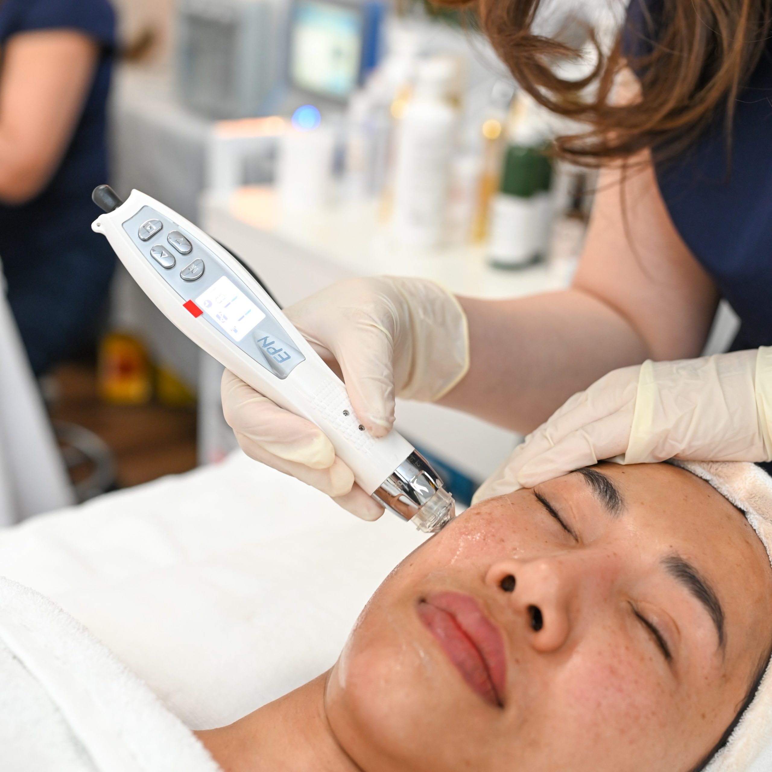 EPN Pen Course – Microneedling Pen Combined with Electroporation Technology